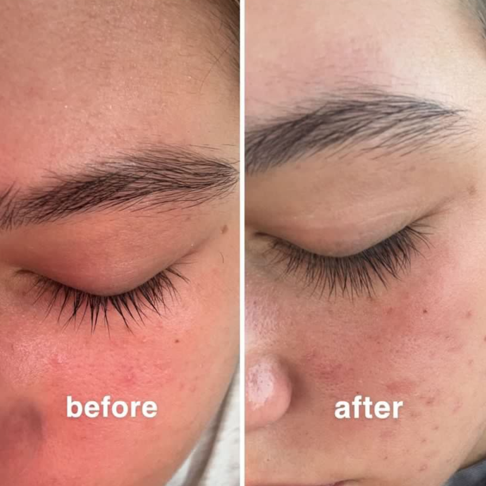 Velledo Eyelash Growth Serum